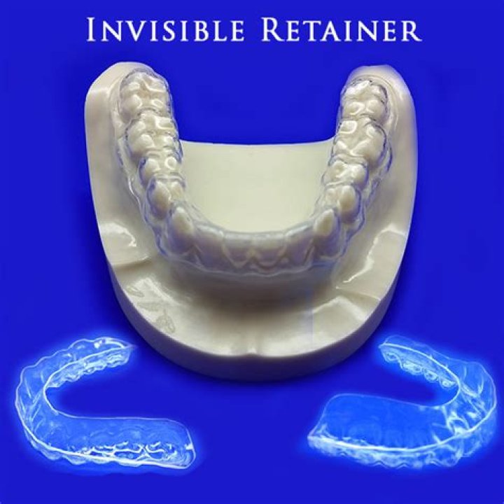 Are metal retainers toxic?