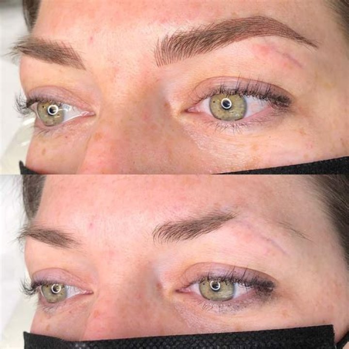 Can 60 year olds get microblading?