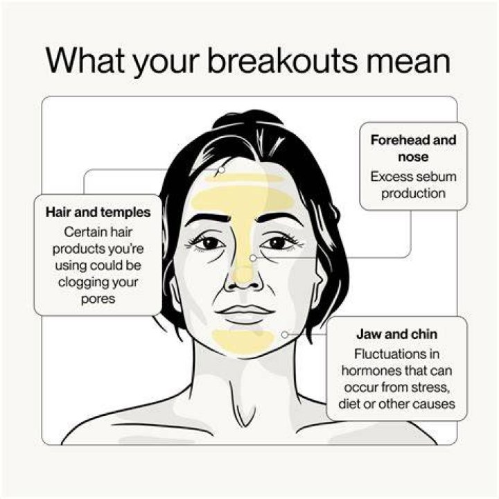 Can face Roller cause breakouts?