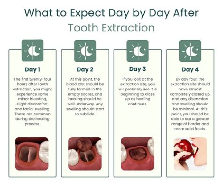 Can I smoke 4 days after tooth extraction?