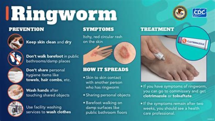Can ringworm live on sheets?