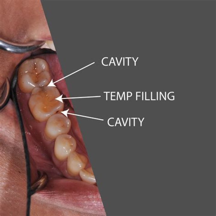 Can teeth last forever?