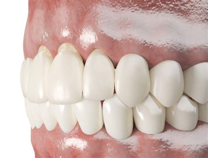 Do gums grow back?