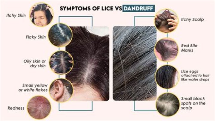 Do lice like African hair?
