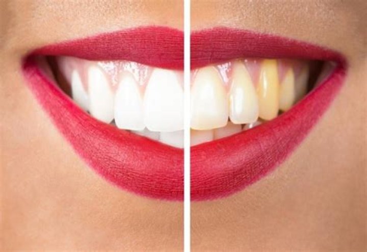 Do red lips make your teeth look yellow?