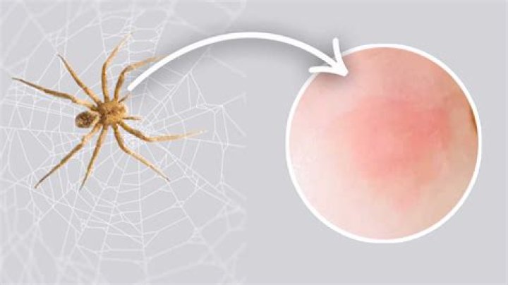 Do spider bites have fluid in them?