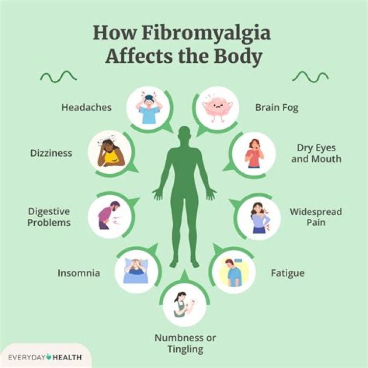 Does Covid affect fibromyalgia?