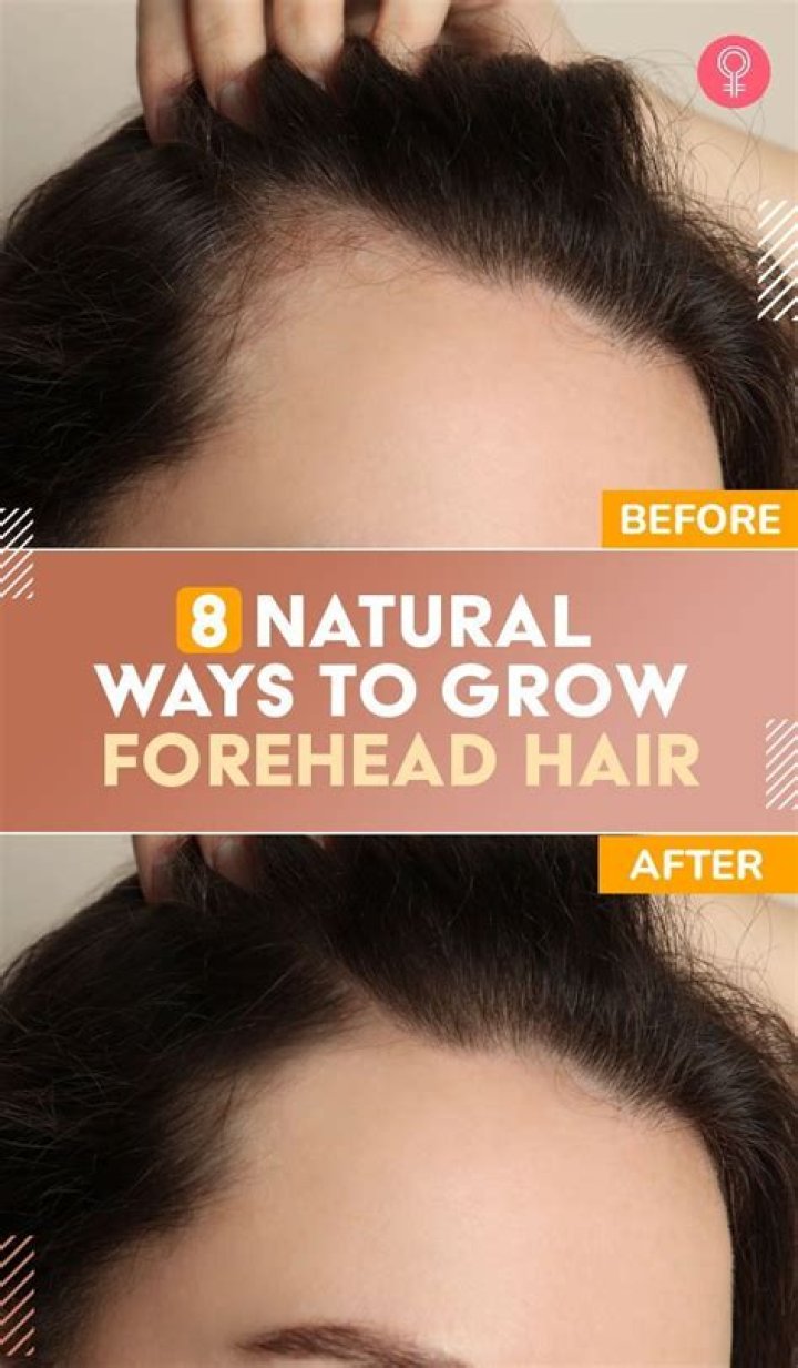 How can I regrow my lost forehead hair?
