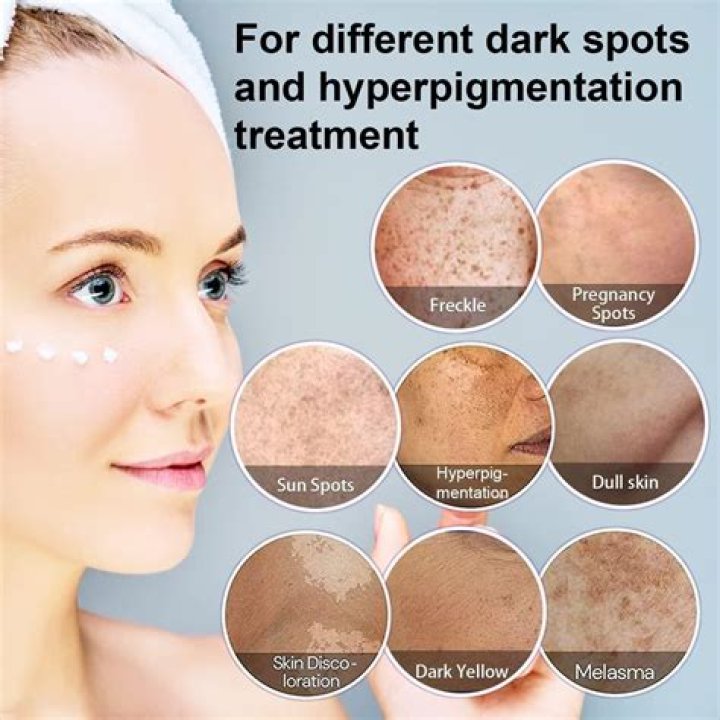 How can I remove the dark spots on my face?