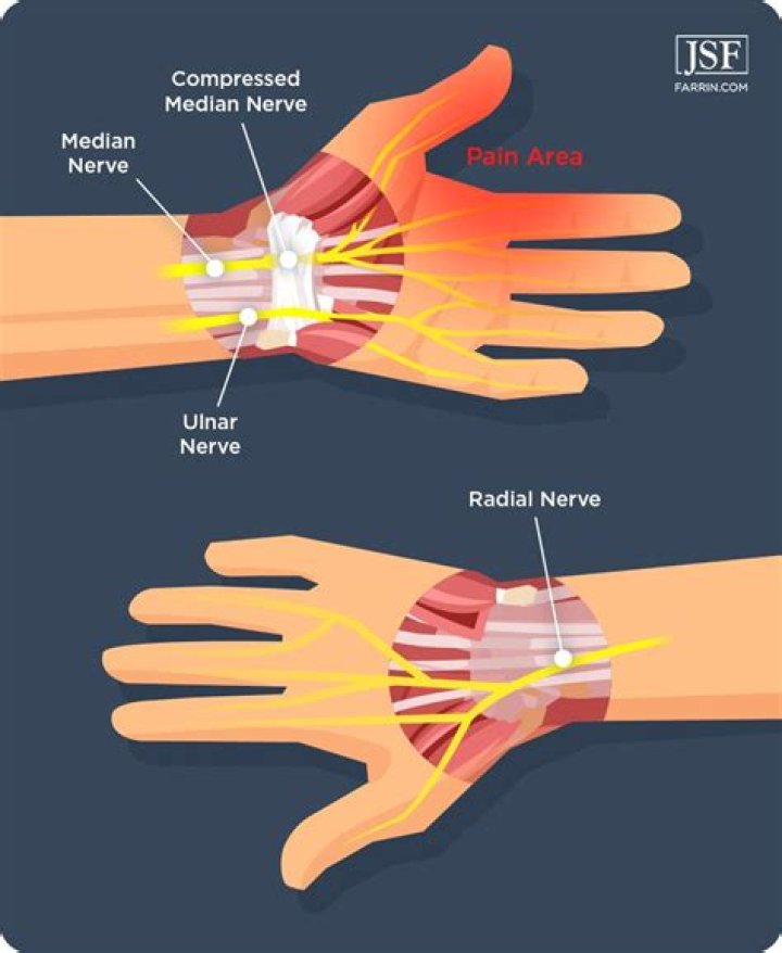 How can you tell if you have nerve damage in your wrist?