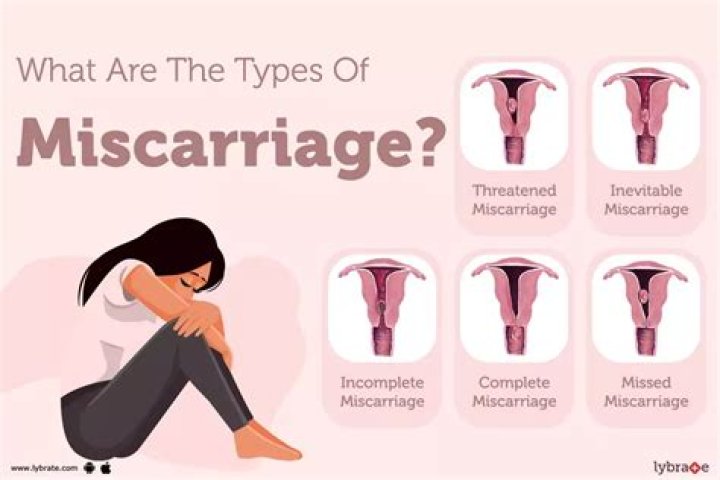 How common is a missed miscarriage?