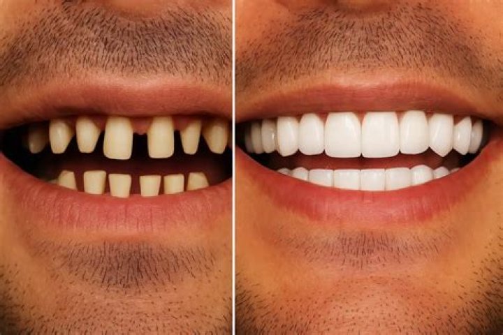 How do black lights make your teeth glow?
