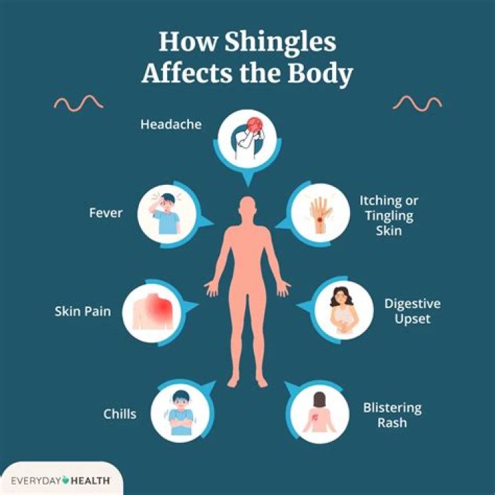How do I know if my rash is shingles?
