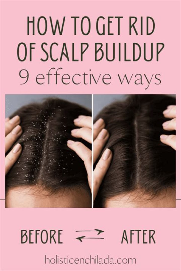 How do you get rid of buildup on dreads?