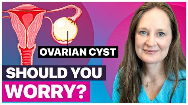 How do you know if you have cysts on your ovaries?