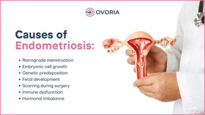 How do you rule out endometriosis?