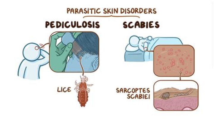 How long is a person with scabies contagious?