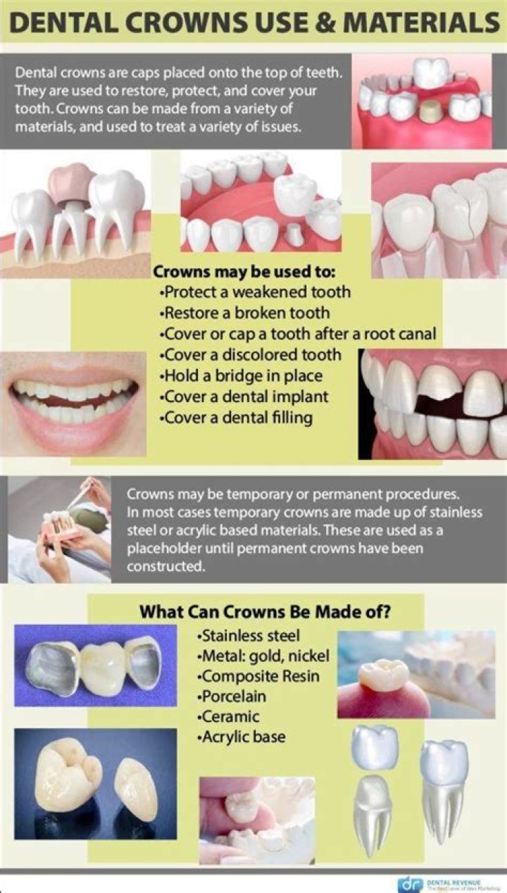 How many dental crowns can you have?