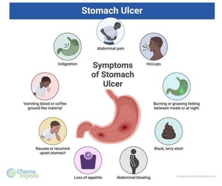 How much is a stomach transplant?