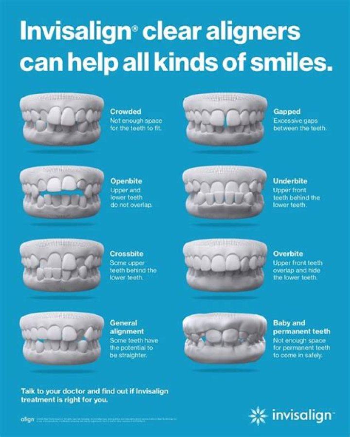 Is 70 too old for Invisalign?