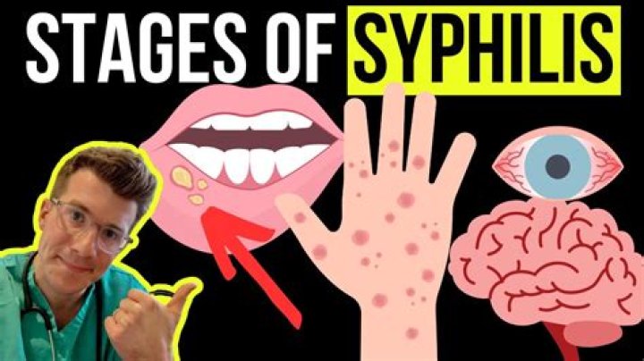 Is a syphilis rash obvious?