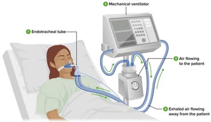 Is a ventilator and life support the same thing?