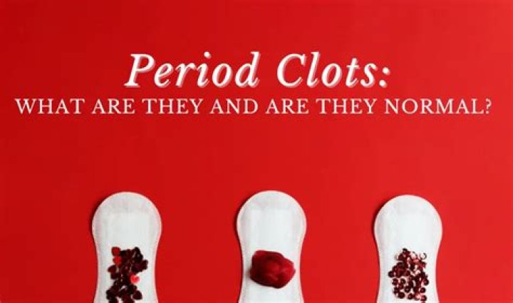 What are clots in period?