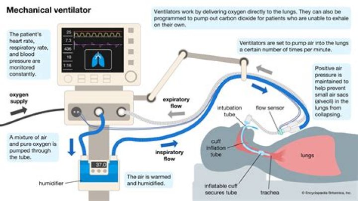 What are the chances of coming off a ventilator with COVID?