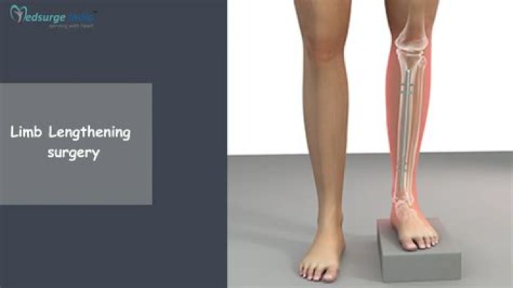 What are the disadvantages of limb lengthening?