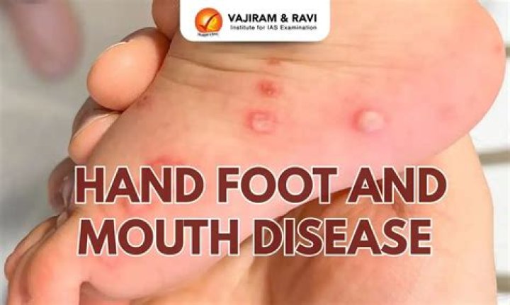What does hand and foot mean?