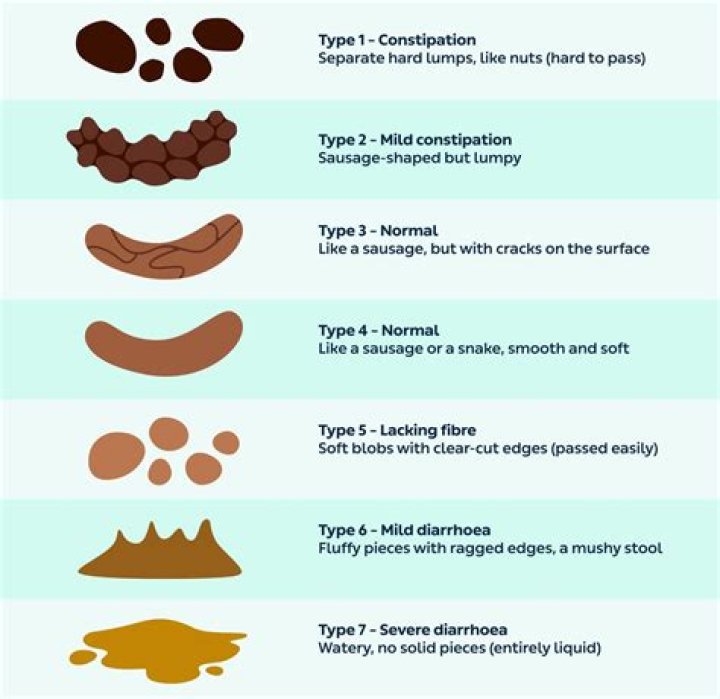 What does your poop look like when you have diverticulitis?