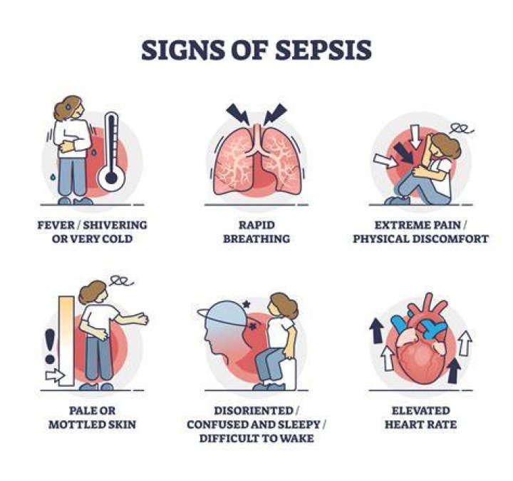 What is most common cause of sepsis?