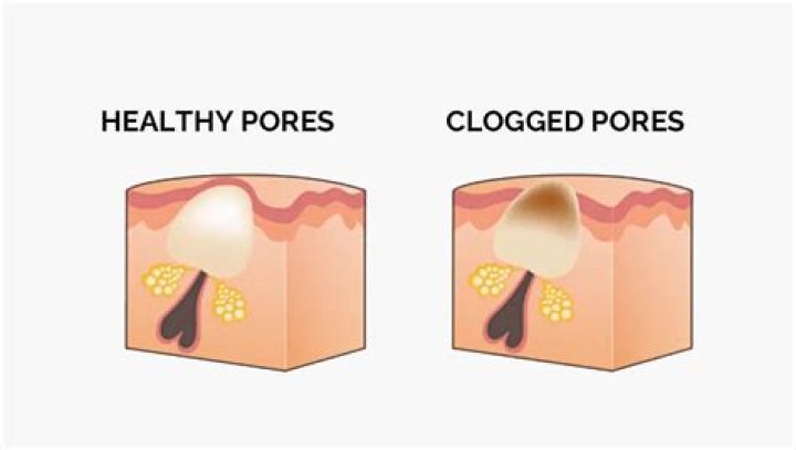 What opens your pores?