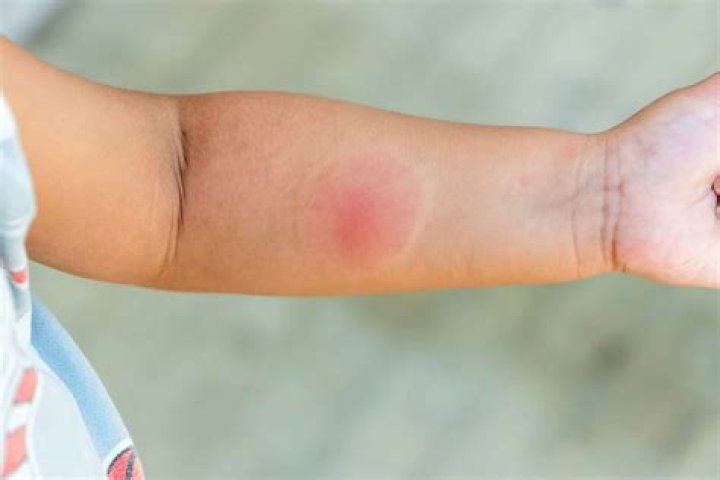 When should I worry about head pressure?