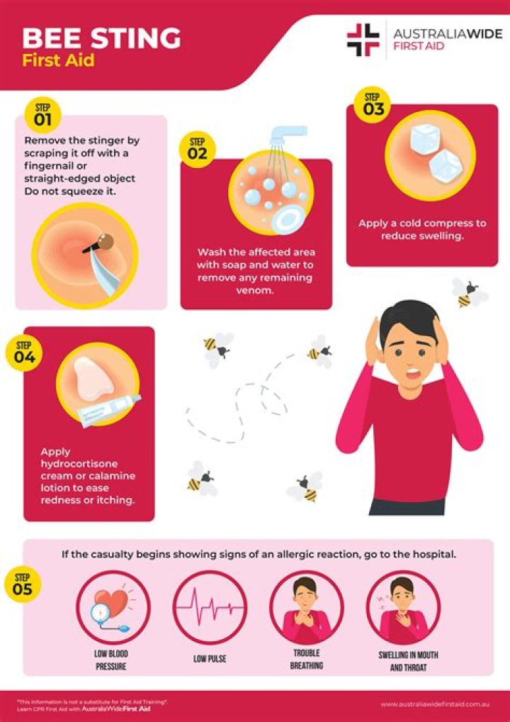 When should you go to the hospital for a bee sting?