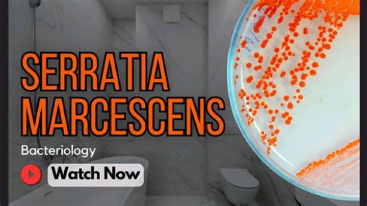Where Serratia marcescens is found?