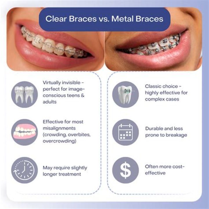 Which braces are more expensive?
