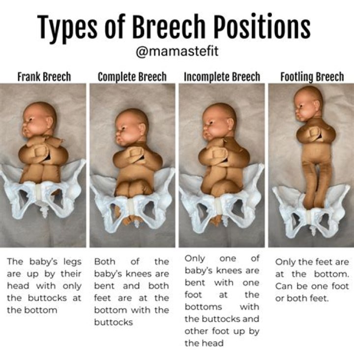 Why are babies held upside down after birth?