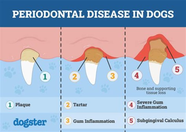 Why does my tongue collect so much plaque?